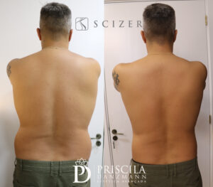 eberson antes costas copiar