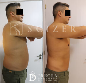 eberson antes lado copiar