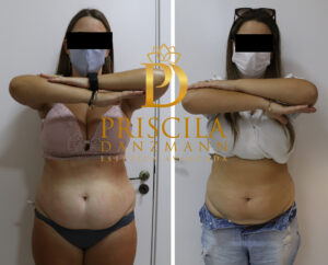 rita beckel antes frente scizer copiar