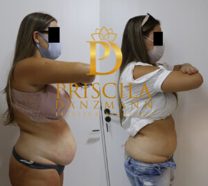 rita beckel antes lado scizer copiar