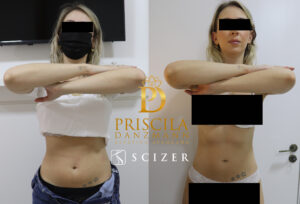 tati copetti antes frente copiar